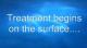 Aquatic therapy by Delphiris helps the disabled